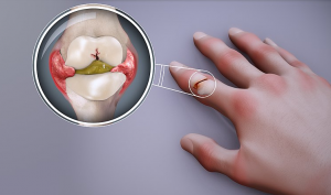 joint pain